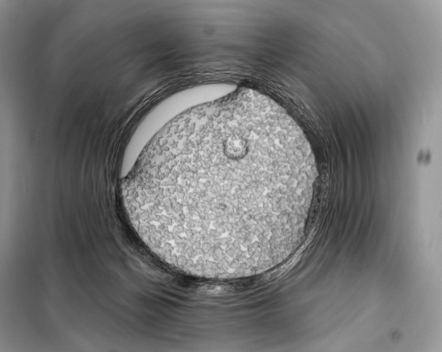 X0000098110174200805021141