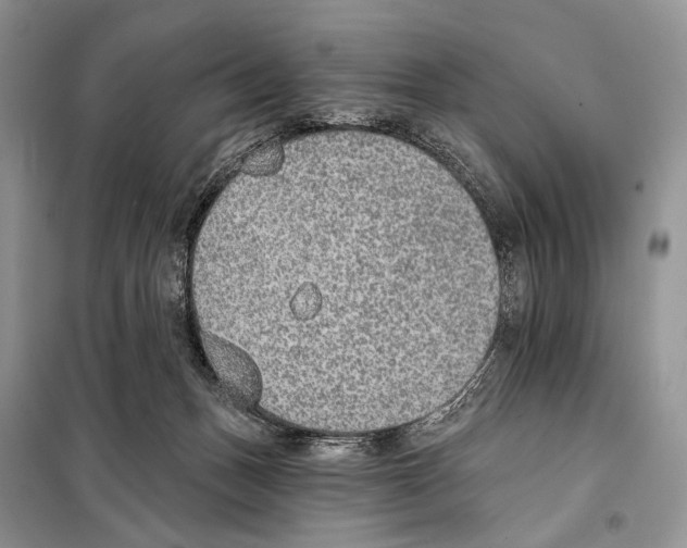 X0000098110175200805021141