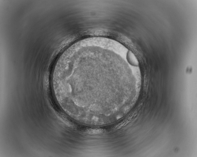 X0000098110202200805021141