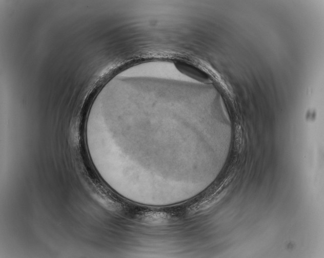 X0000098110203200805021141