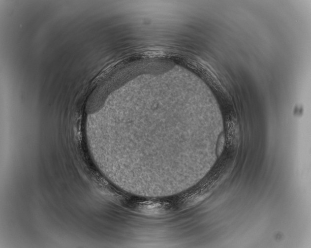 X0000098110267200805021139