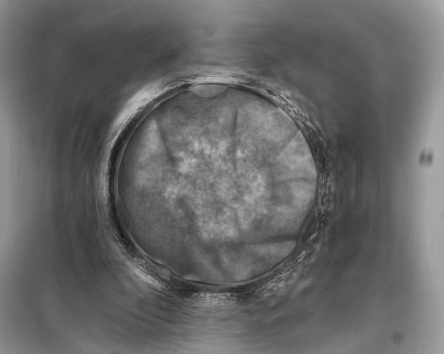 X0000098110296200805021139