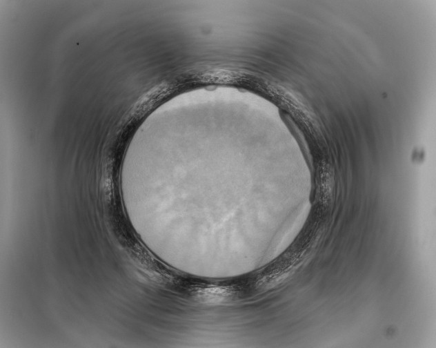 X0000098110312200805021139