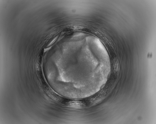 X0000098110316200805021139