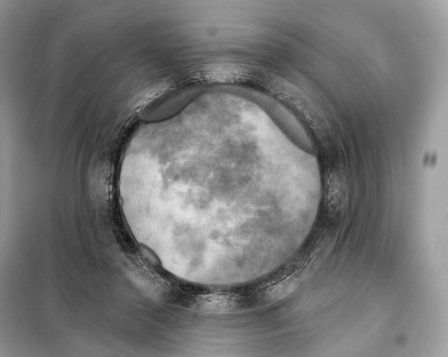 X0000098110356200805021138