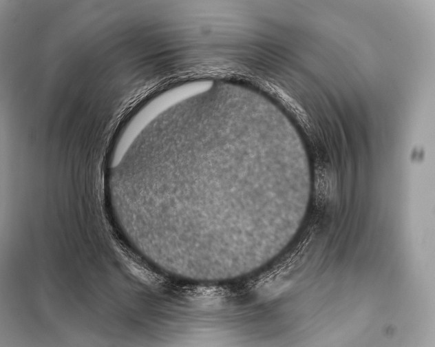 X0000098110493200805021136