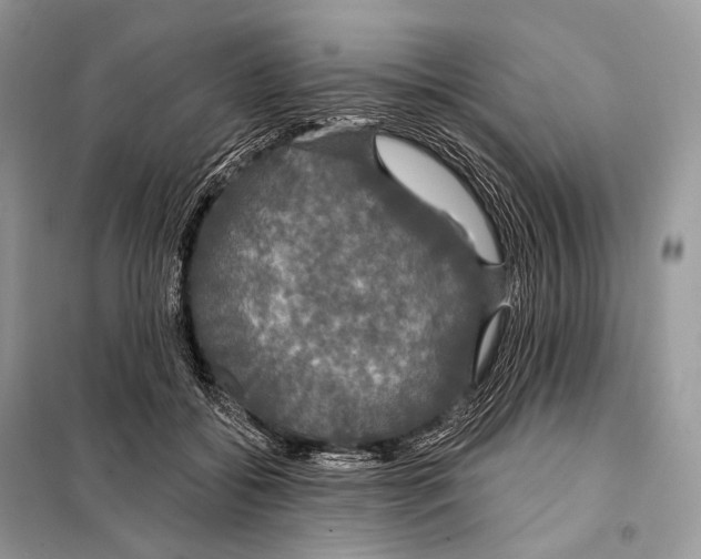 X0000098110556200805021135