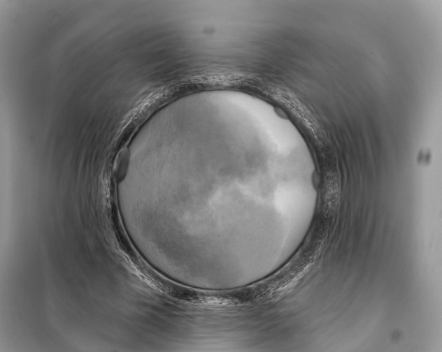 X0000098110585200805021134