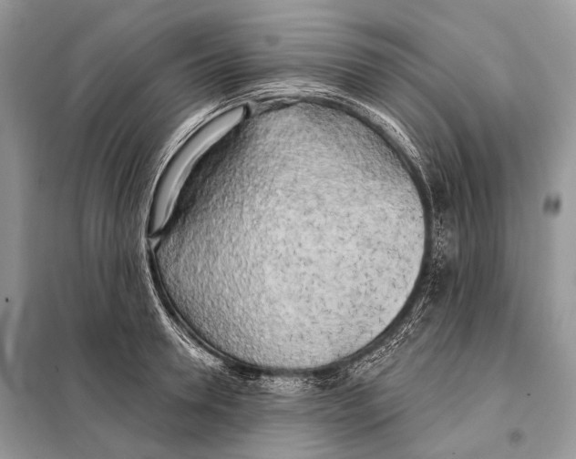 X0000098110946200805021130