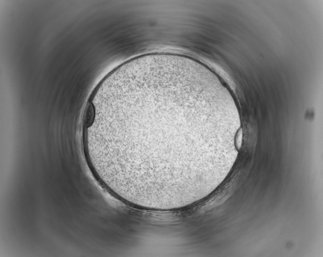 X0000098111007200805021128