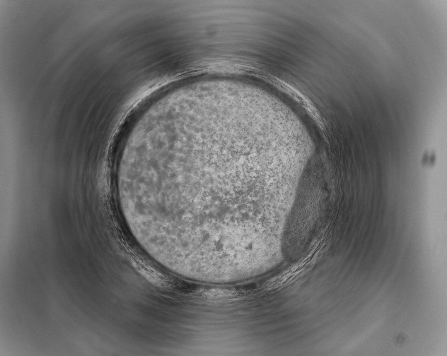 X0000098111027200805021128