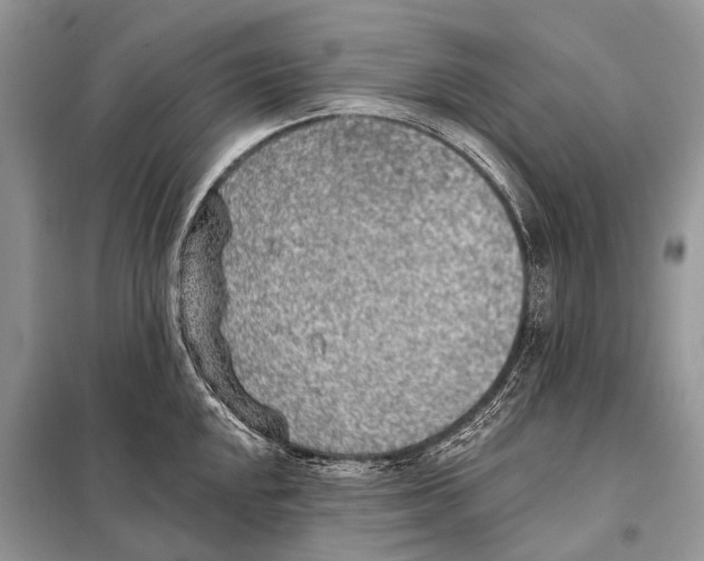 X0000098111048200805021128