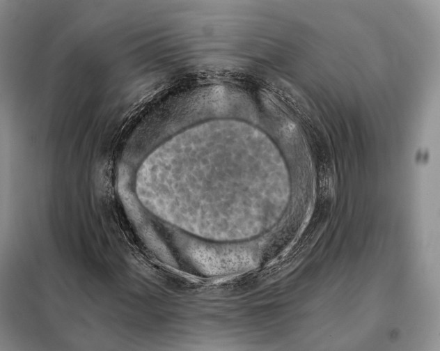 X0000098111060200805021128