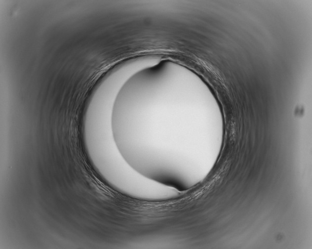 X0000098111161200805021126