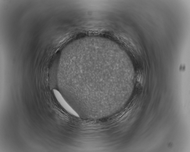 X0000098111252200805021125