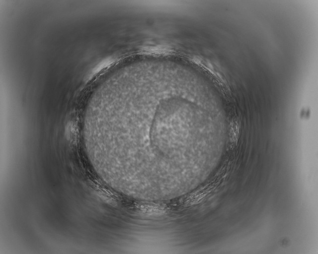 X0000098111254200805021125