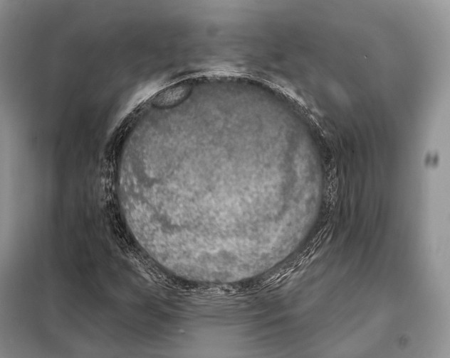 X0000098111255200805021125