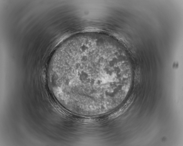 X0000098111401200805021122