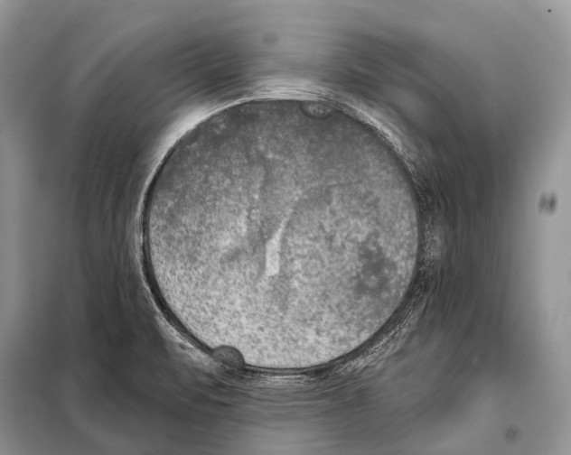 X0000098111471200805021122