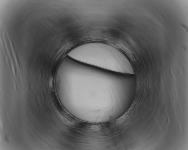 X0000098120166200804040831