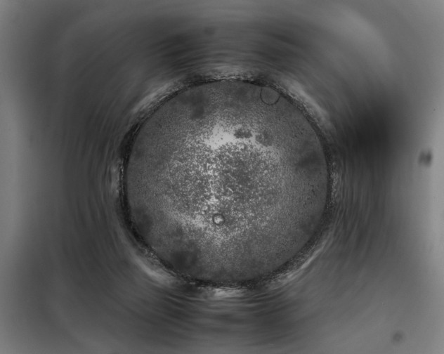 X0000098120165200804041416