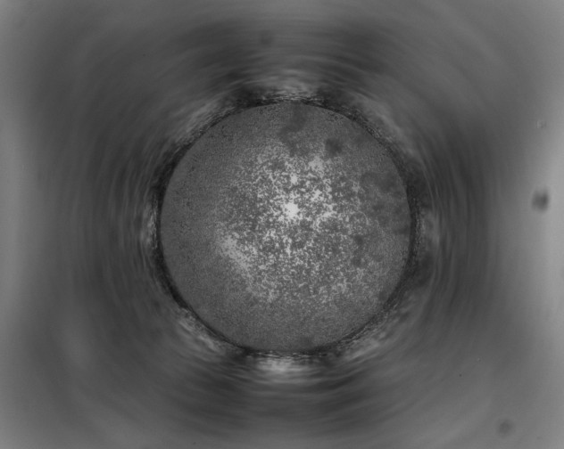 X0000098120177200804041416