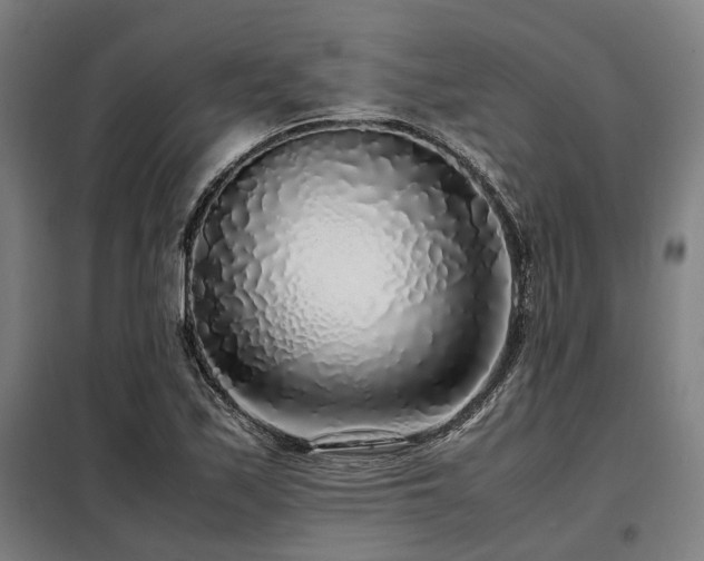 X0000098121171200804041401
