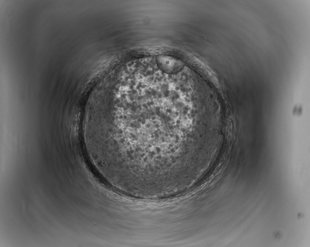 X0000098120018200804181533