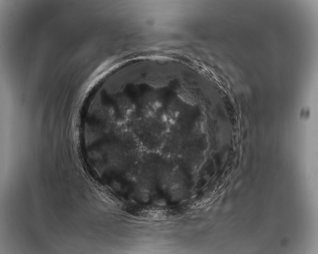 X0000098120295200804181528
