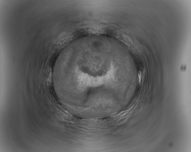 X0000098121251200804181510