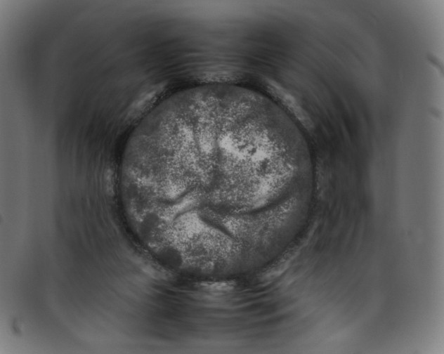 X0000098120161200804251500