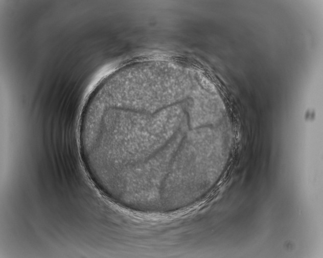 X0000098120006200805021207