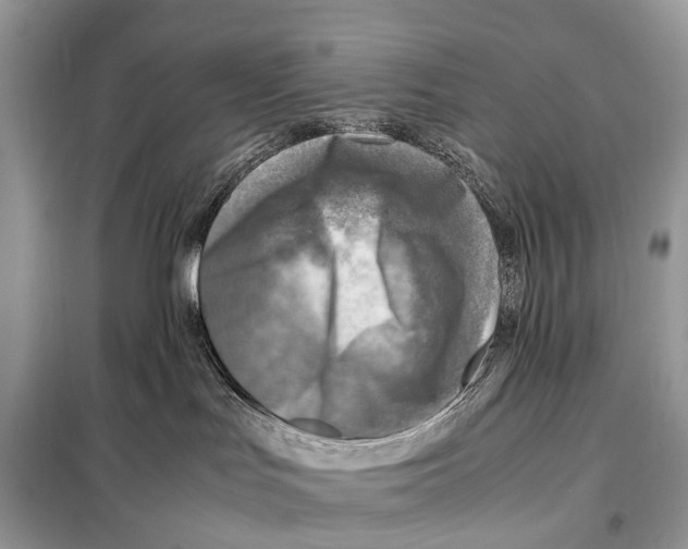 X0000098120047200805021207