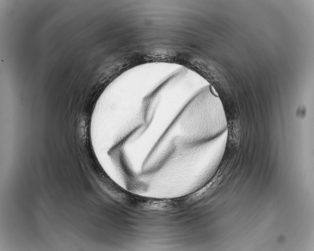 X0000098120086200805021207