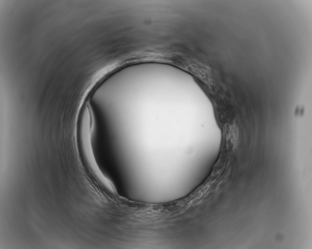 X0000098120148200805021205