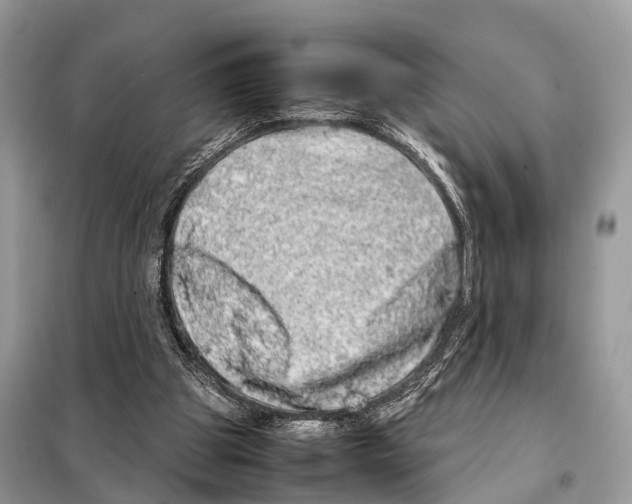 X0000098120153200805021205