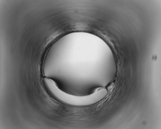 X0000098120154200805021205