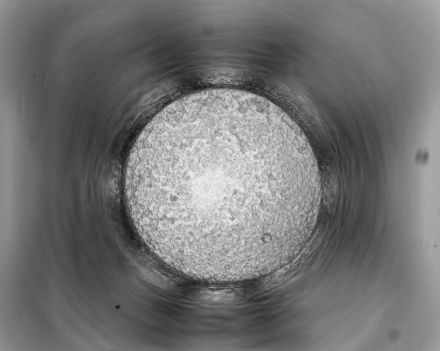 X0000098120175200805021205