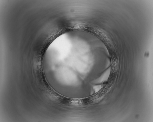 X0000098120415200805021201