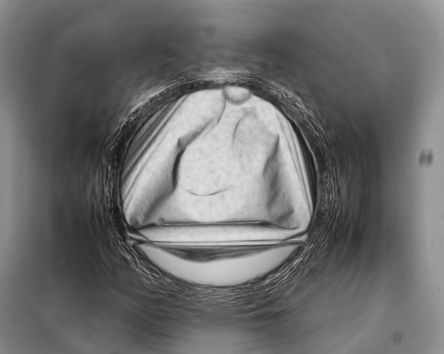 X0000098121158200805021149