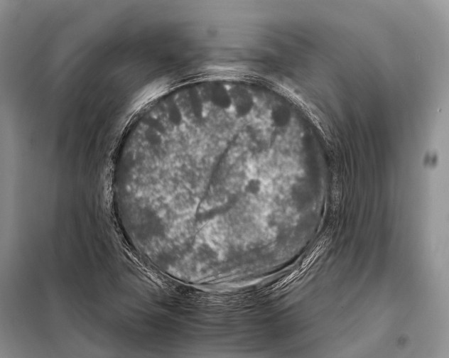 X0000098121411200805021145