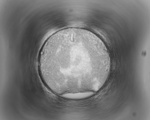 X0000098121471200805021145