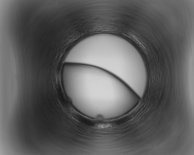 X0000098130500200804171102