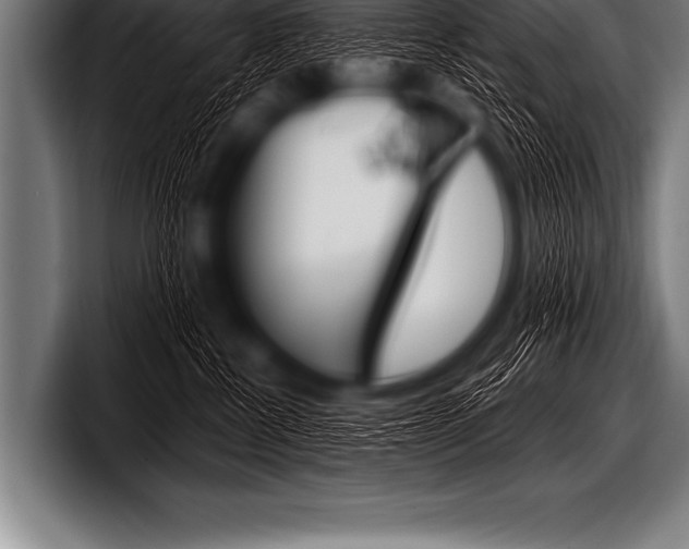 X0000098130570200804171101