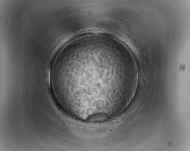 X0000098130014200804171533