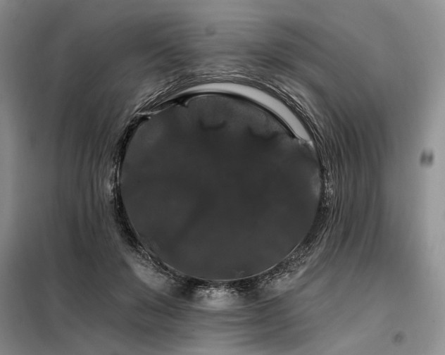 X0000098130503200804171525