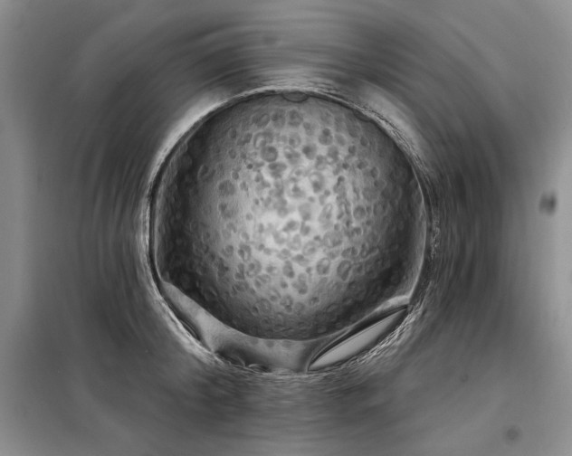 X0000098130804200804171520