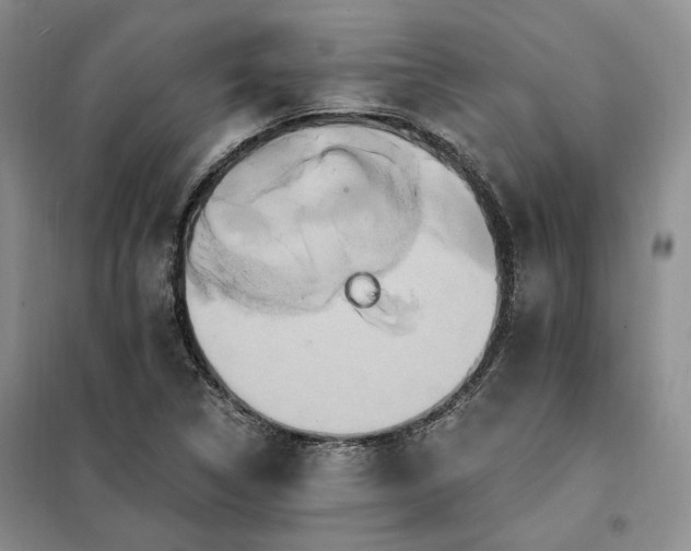 X0000098131314200804171511