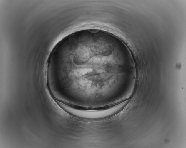 X0000098131522200804171508