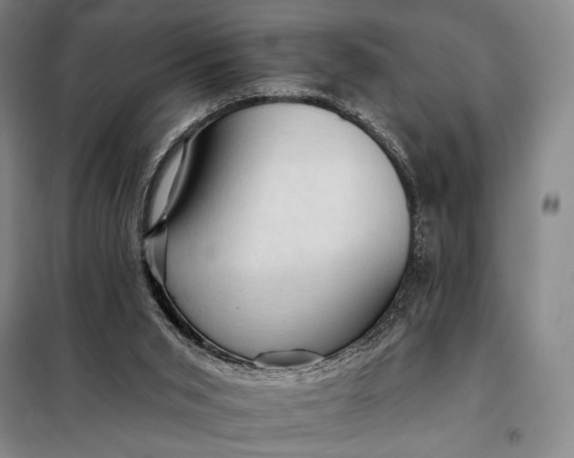 X0000098130015200805011331